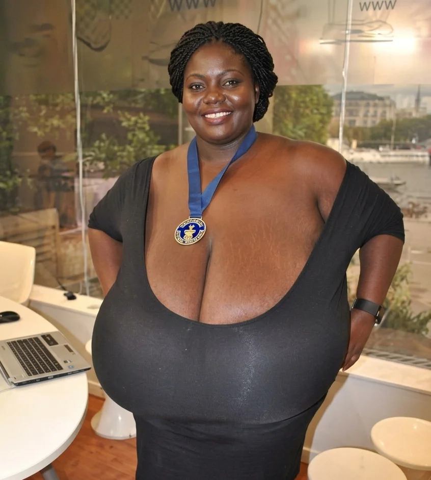 Breast Reduction — plastic surgery procedure by Dr. Adelaida